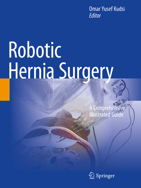 Robotic Hernia Surgery - 