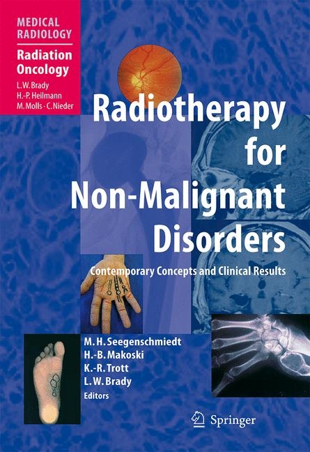 Radiotherapy for Non-Malignant Disorders -  Michael H. Seegenschmiedt,  Hans-Bruno Makoski,  Klaus-Rüdiger Trott
