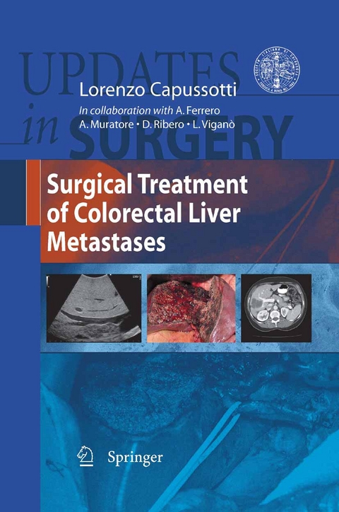 Surgical Treatment of Colorectal Liver Metastases - 
