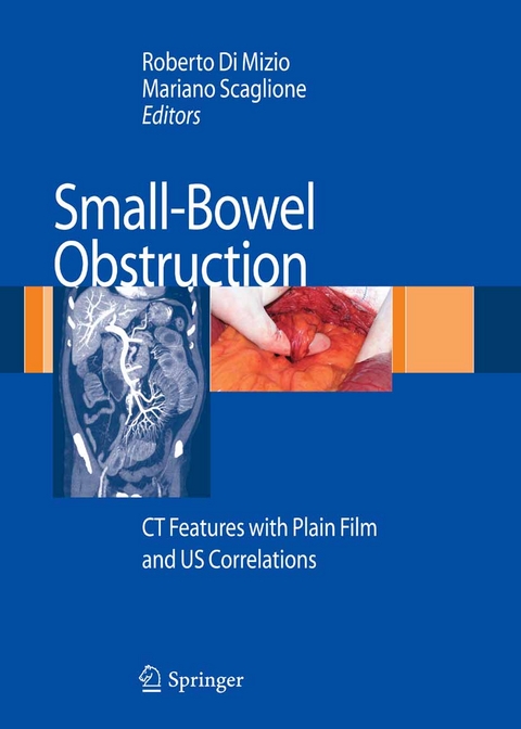 Small-Bowel Obstruction - 