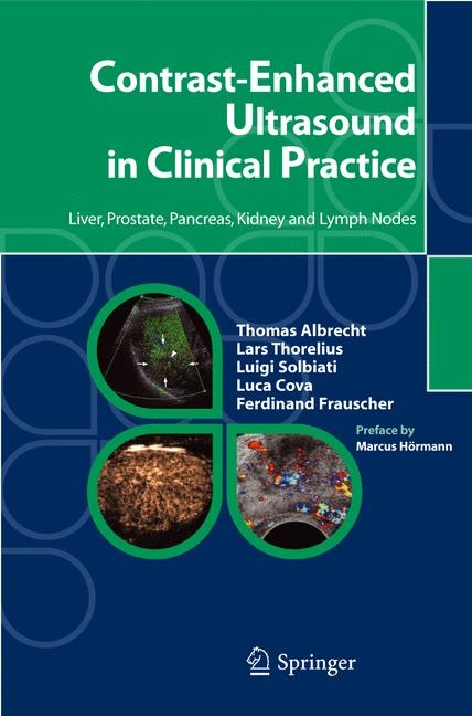 Contrast-Enhanced Ultrasound in Clinical Practice -  Thomas Albrecht,  Luca Cova,  Ferdinand Frauscher,  Luigi Solbiati,  Lars Thorelius