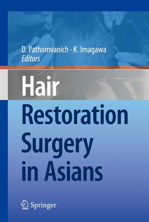 Hair Restoration Surgery in Asians - 