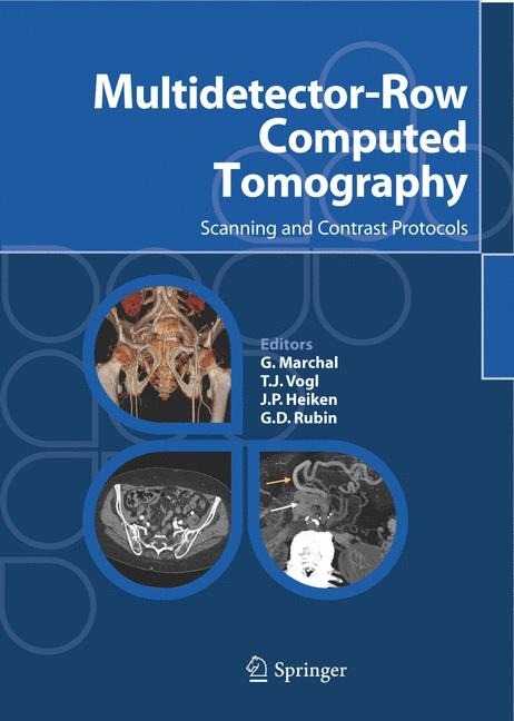 Multidetector-Row Computed Tomography - 