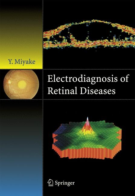 Electrodiagnosis of Retinal Disease - Yozo Miyake