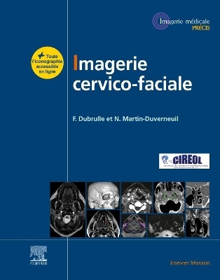 Imagerie cervicofaciale - Frédérique Dubrulle, Nadine Martin-Duverneuil