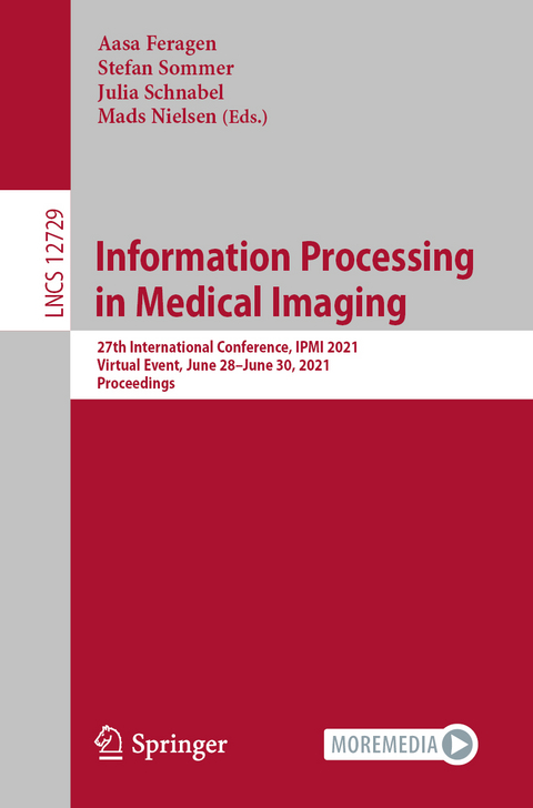 Information Processing in Medical Imaging - 