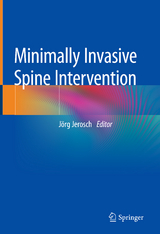 Minimally Invasive Spine Intervention - 