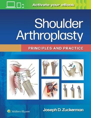 Shoulder Arthroplasty - Joseph D. Zuckerman