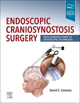 Endoscopic Craniosynostosis Surgery - 