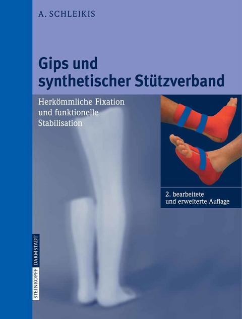 Gips und synthetischer Stützverband - A. Schleikis