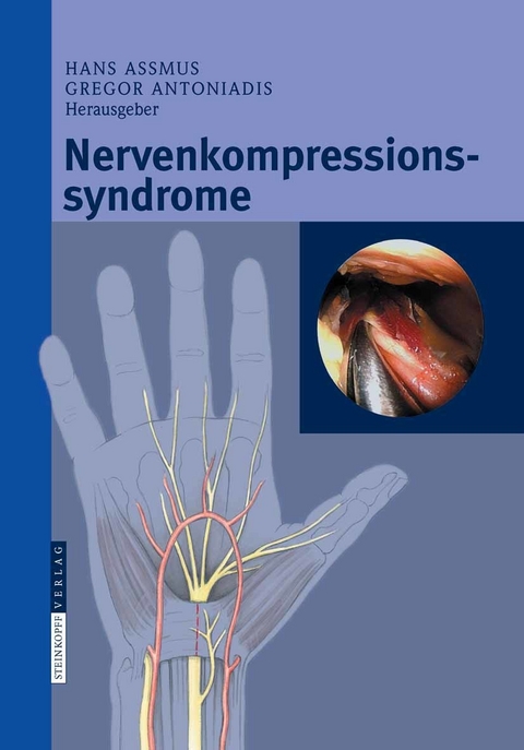 Nervenkompressionssyndrome - 