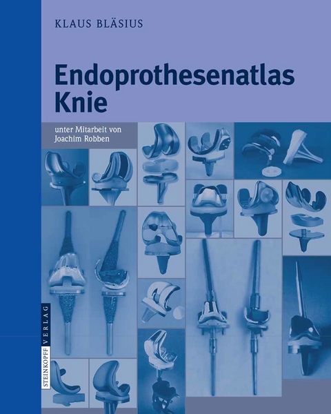 Endoprothesenatlas Knie - Klaus Bläsius