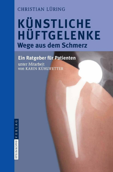 Künstliche Hüftgelenke - C. Lüring