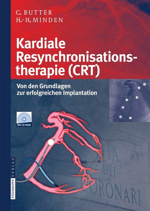 Kardiale Resynchronisationstherapie (CRT) - Christian Butter, Hans-Heinrich Minden