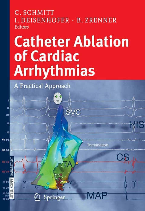 Catheter Ablation of Cardiac Arrhythmias - 