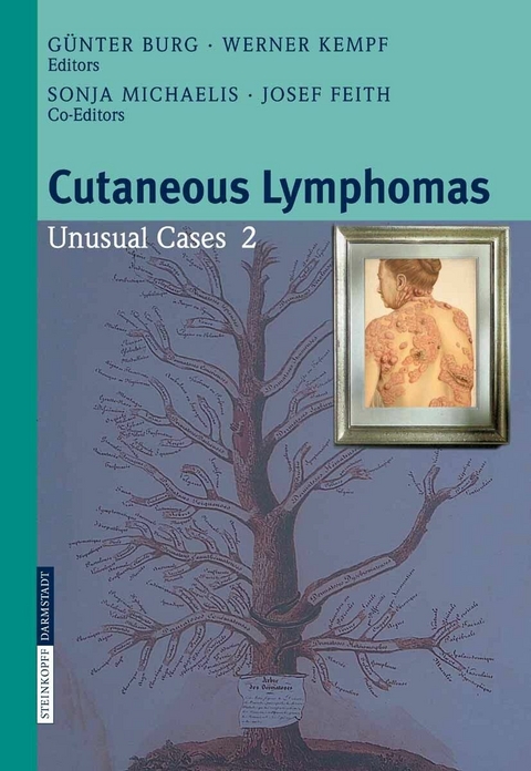 Cutaneous Lymphomas - 