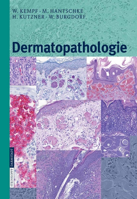 Dermatopathologie - W. Kempf, Markus Hantschke, H. Kutzner, W. Burgdorf