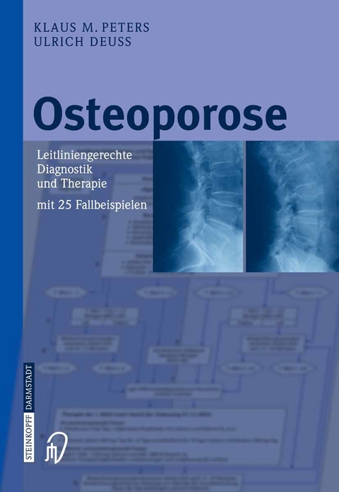 Osteoporose - Klaus M. Peters, Ulrich Deuß