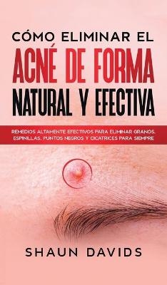 Cómo Eliminar el Acné de Forma Natural y Efectiva - Shaun Davids