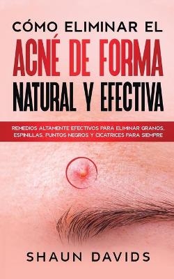 Cómo Eliminar el Acné de Forma Natural y Efectiva - Shaun Davids