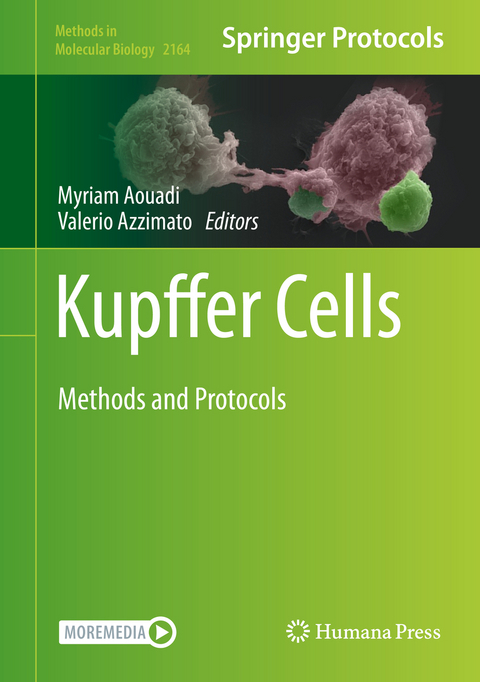 Kupffer Cells - 