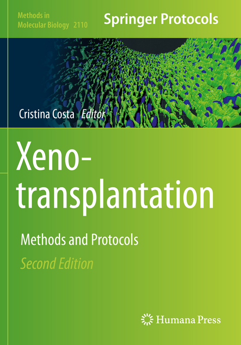 Xenotransplantation - 