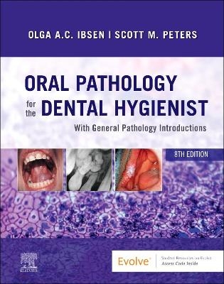 Oral Pathology for the Dental Hygienist - Olga A. C. Ibsen, Scott Peters