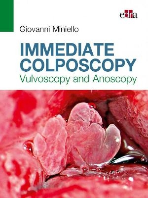 Immediate Colposcopy - Vulvoscopy and Anoscopy - Giovanni Miniello