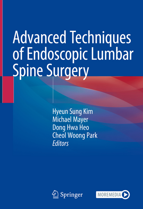 Advanced Techniques of Endoscopic Lumbar Spine Surgery - 