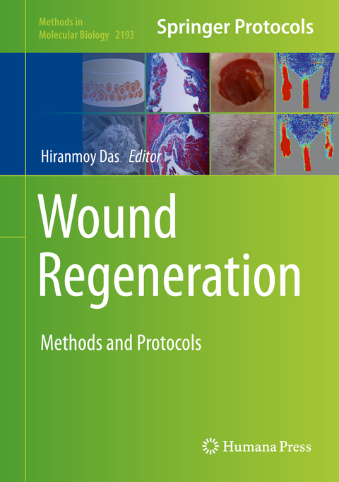 Wound Regeneration - 