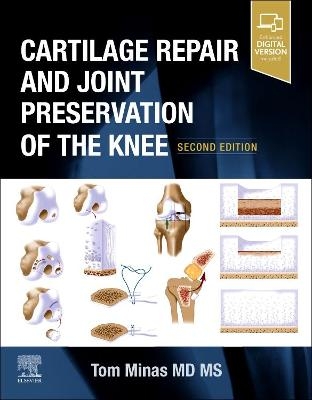 Cartilage Repair and Joint Preservation of the Knee - Tom Minas