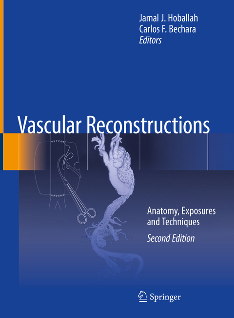 Vascular Reconstructions - 