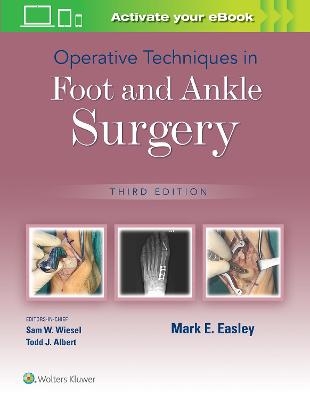 Operative Techniques in Foot and Ankle Surgery - Mark E. Easley