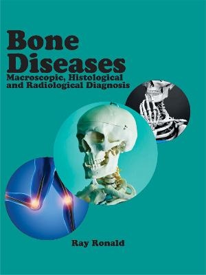 Bone Diseases: Macroscopic, Histological and Radiological Diagnosis - 