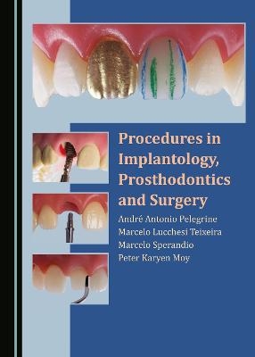 Procedures in Implantology, Prosthodontics and Surgery - André Antonio Pelegrine, Marcelo Lucchesi Teixeira, Marcelo Sperandio