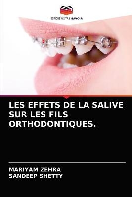 Les Effets de la Salive Sur Les Fils Orthodontiques. - Mariyam Zehra, Sandeep Shetty