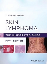 Skin Lymphoma - Cerroni, Lorenzo