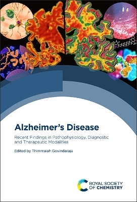 Alzheimer's Disease - 