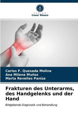 Frakturen des Unterarms, des Handgelenks und der Hand - Carlos F Quesada Molina, Ana Milena Muñoz, Marta Revelles Paniza