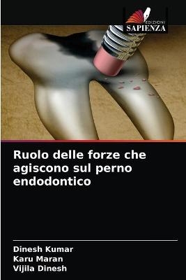 Ruolo delle forze che agiscono sul perno endodontico - Dinesh Kumar, Karu Maran, Vijila Dinesh