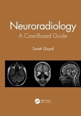 Neuroradiology - Swati Goyal