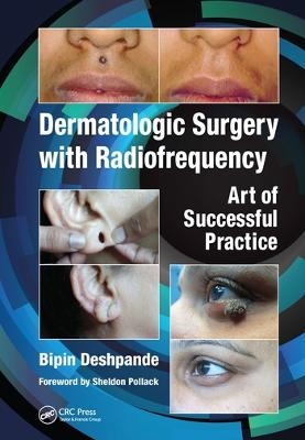 Dermatologic Surgery with Radiofrequency - Bipin Deshpande