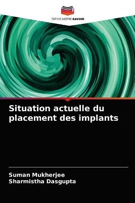 Situation actuelle du placement des implants - Suman Mukherjee, Sharmistha Dasgupta