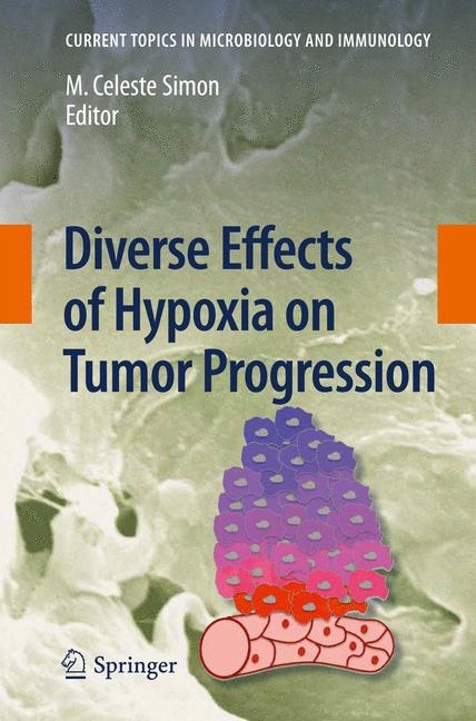 Diverse Effects of Hypoxia on Tumor Progression - 
