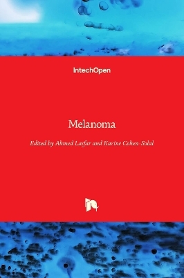 Melanoma - 