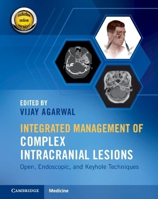 Integrated Management of Complex Intracranial Lesions Hardback Set and Static Online Product - 
