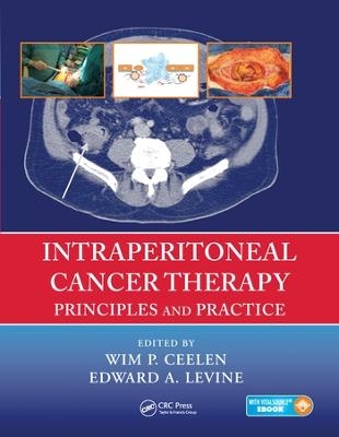 Intraperitoneal Cancer Therapy - 