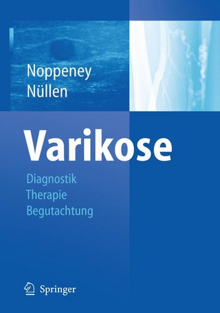 Varikose - Thomas Noppeney; Thomas Noppeney; Helmut Nüllen; Helmut Nüllen
