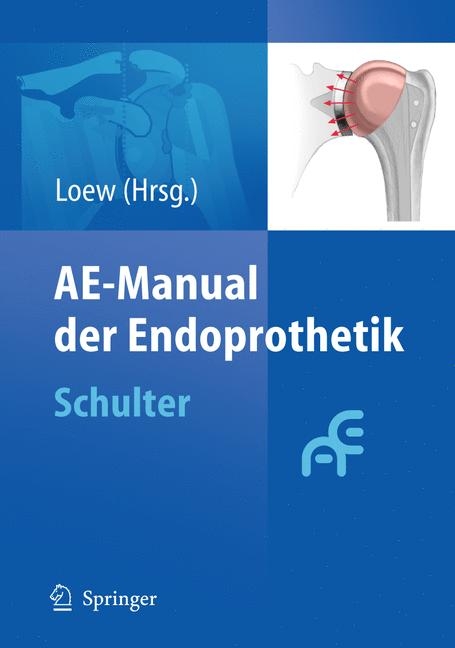 AE-Manual der Endoprothetik -  Markus Loew