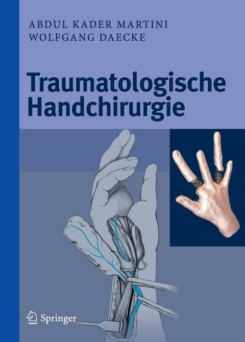 Traumatologische Handchirurgie -  Abdul Kader Martini,  Wolfgang Daecke